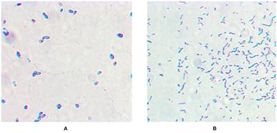 A Comparative Study on the Biodegradation of 17β-Estradiol by Candida utilis CU-2 and Lactobacillus casei LC-1